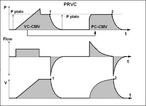 Первый и второй вдохи в режиме «PRVC»